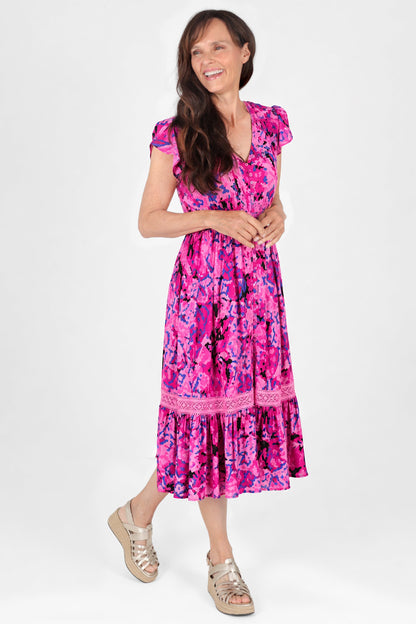 Lace Trim Button Front Midi Dress