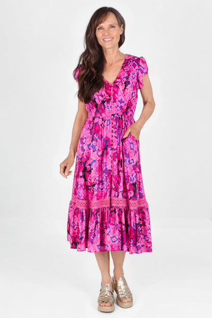 Lace Trim Button Front Midi Dress