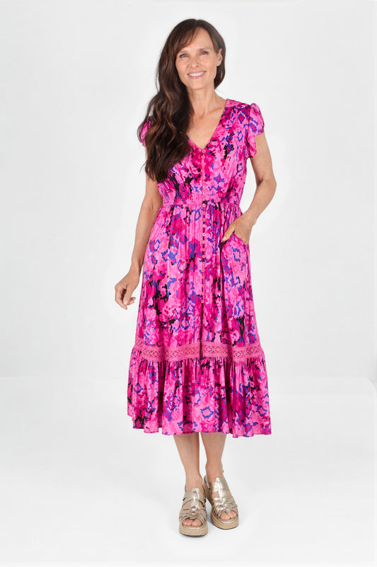 Lace Trim Button Front Midi Dress